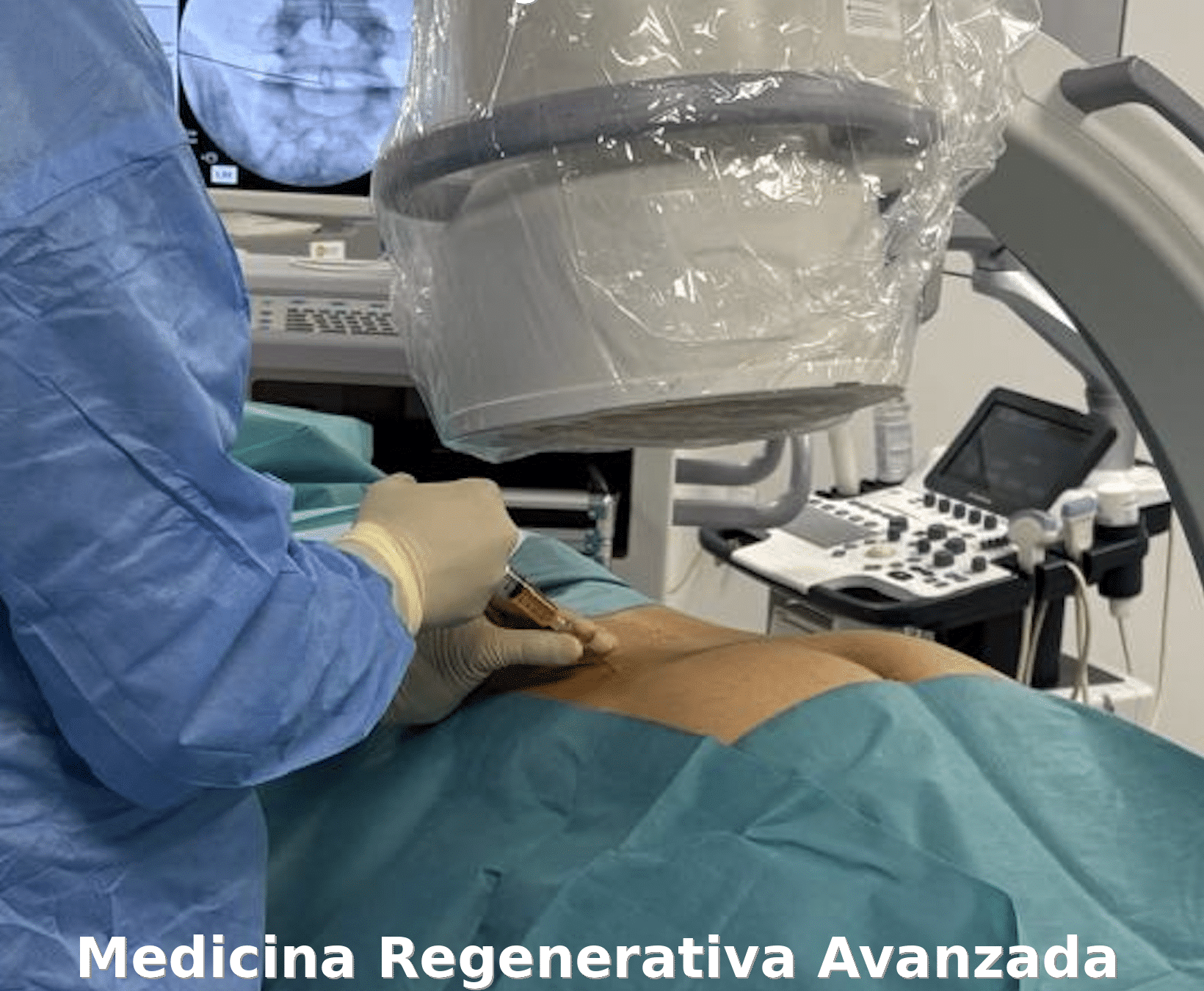 PRP lumbar y FSU: evidencia científica y medicina regenerativa de la Unidad Funcional Espinal