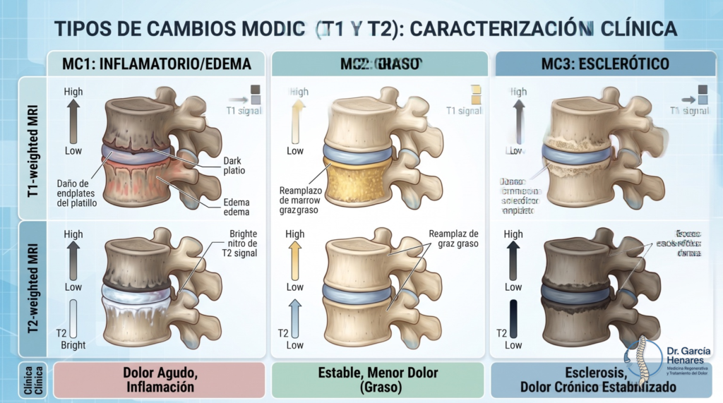 Cambios Modic tipo 1, 2 y 3 en resonancia magnética lumbar en secuencias T1 y T2, y lesiones mixtas.