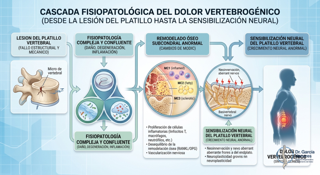 Cascada fisiopatológica del dolor vertebrogénico: daño del platillo, inflamación y señal del nervio basivertebral.